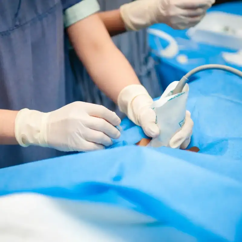 ultrasound_guided_surgery